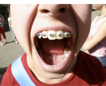 Willensfreiheit und gedankliches Mitläufertum —